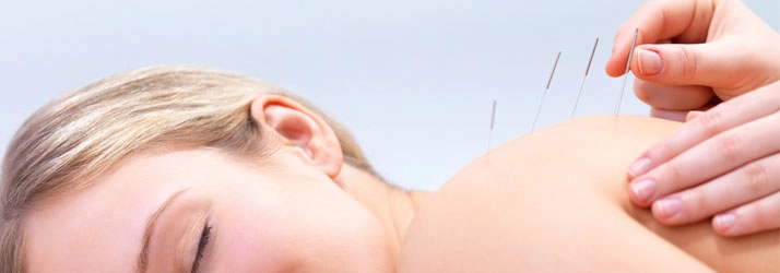 Chiropractic-Auburn-WA-Acupuncture-1.webp low back pain relief with chiropractic care